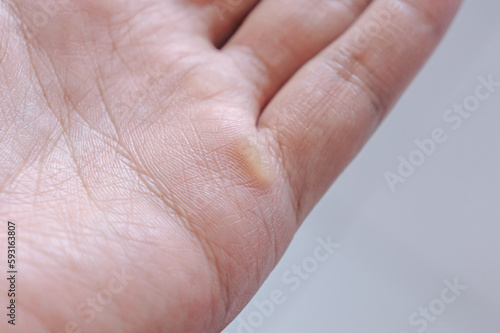 Selective focus of man hand with callus on palm photo