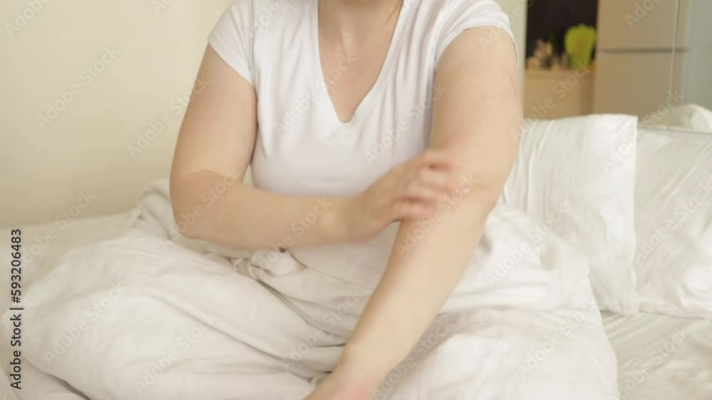 allergic itching, food allergy and spring bloom, woman itching at home allergic itching, food allergy and spring bloom, woman itching at home