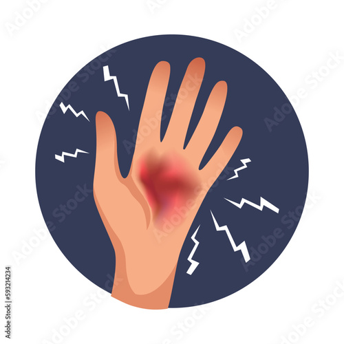 Hand Burn Icon