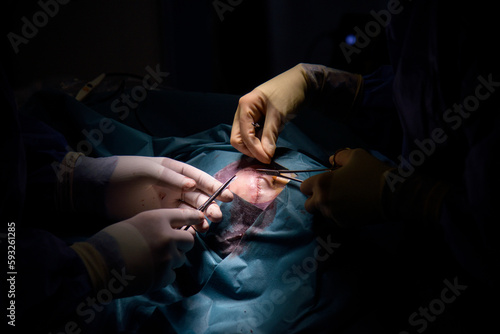 Closeup of surgeons gloved hands with the instruments during face plastic surgery Doctor in gloves holds medical instrument during wound suturing