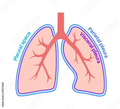 Pleura anatomical poster