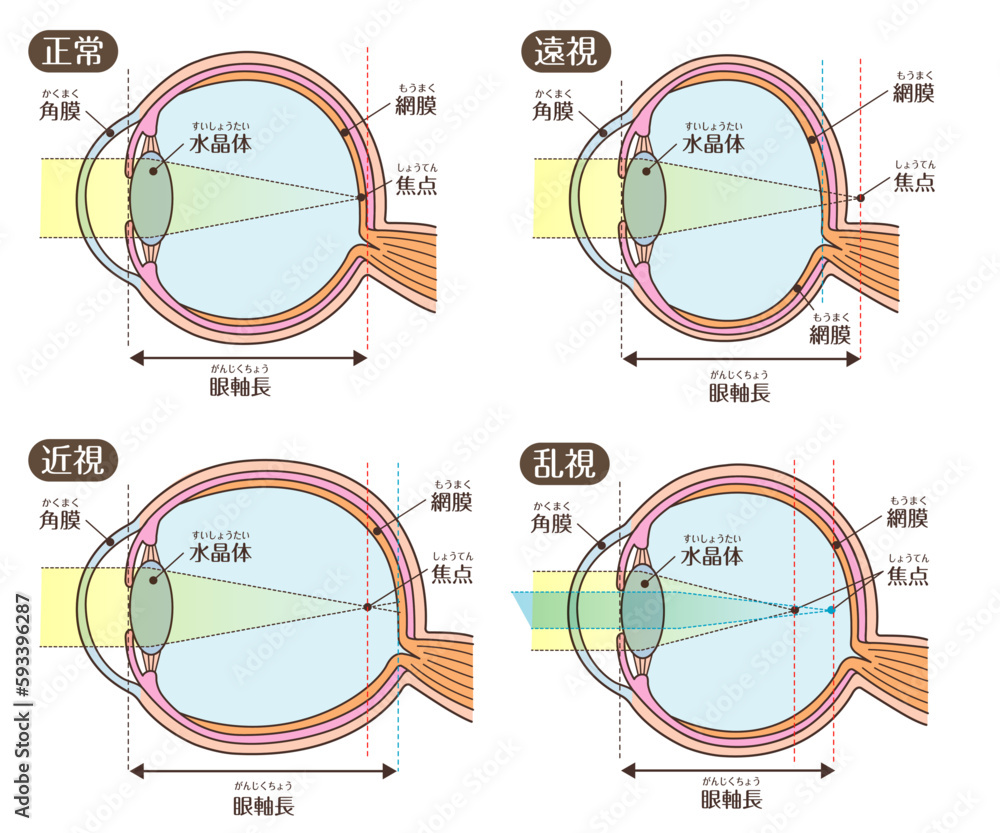 目の構造_視力(近視・遠視・乱視) Stock Vector | Adobe Stock