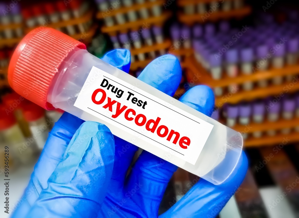 Urine sample for Oxycodone drug test. Oxycodone testing. Urine sample in test tube.