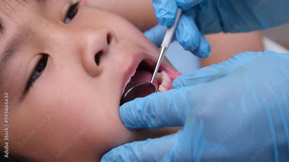 Close-up inside the oral cavity of a healthy child with beautiful rows of baby teeth. Young girl opens mouth revealing upper and lower teeth, hard palate, soft palate, dental and oral health checkup. Close-up inside the oral cavity of a healthy child with beautiful rows of baby teeth. Young girl opens mouth revealing upper and lower teeth, hard palate, soft palate, dental and oral health checkup.