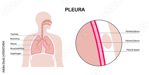 Pleura anatomical poster