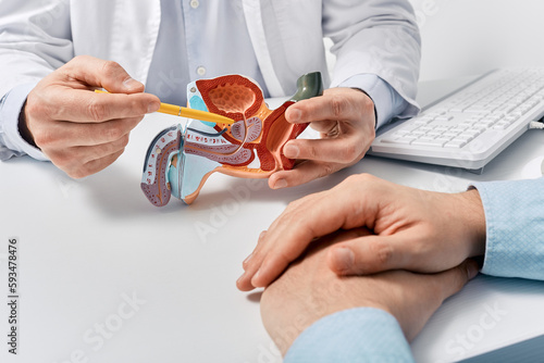 Prostate disease and treatment. Male reproductive system anatomical model in doctors hands close-up during consultation of male patient with suspected bacterial prostatitis photo