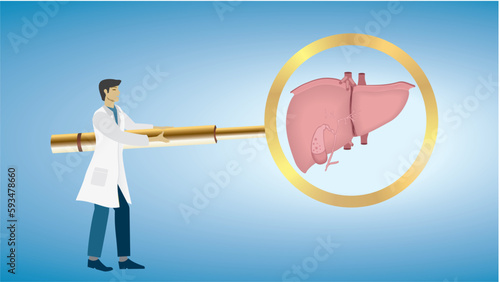 Man, doctor with on big magnifying glass , focus, looking at liver,  iecur. Liver cirrhosis, dysfunction. Dimension 16:9. Vector illustration. photo