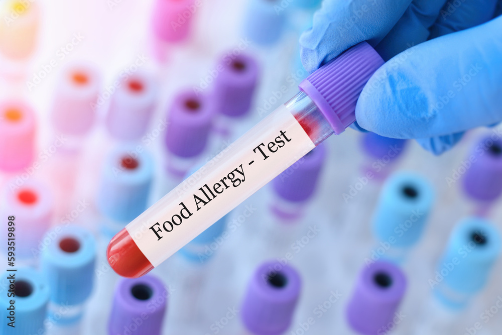 Obraz premium Doctor holding a test blood sample tube with food allergy test on the background of medical test tubes with analyzes