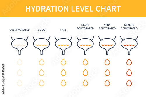 Urine color chart diagram. Bladders with urine showing different hydration level. Straw yellow to brown pee specimen. Medical concept. Vector illustration.