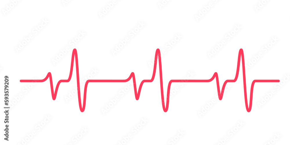 heart rhythm graph Checking your heartbeat for diagnosis