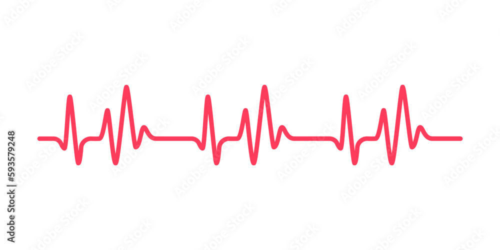 heart rhythm graph Checking your heartbeat for diagnosis heart rhythm graph Checking your heartbeat for diagnosis