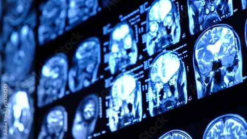Close-up of CT scan with brain. Medicine, science and education MRI brain background. Magnetic resonance imaging. Tomography shot.