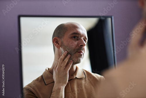 Tableau sur toile Closeup portrait of insecure bald man looking in mirror at home and inspecting f