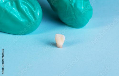 A dentist in a green glove holds a milk tooth on a blue background. Extraction of teeth in children, pediatric dentistry. Close-up photo