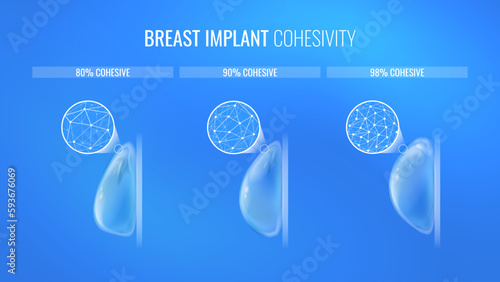 Breast implant density types for mammoplasty in a realistic style. Infographic concept for plastic surgery clinic banner. Vector illustration in futuristic style with light effects