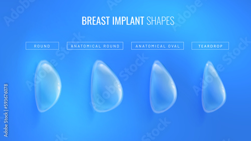 Types of breast implant for plastic surgery in a realistic style. Infographic concept for plastic surgery clinic banner. Vector illustration in futuristic style with light effects