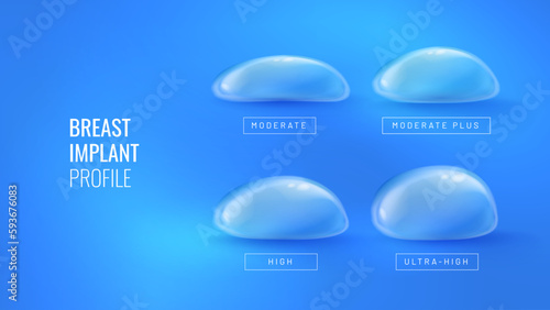 Breast implant profile for plastic surgery in realistic style. Infographic concept for plastic surgery clinic banner. Vector illustration in futuristic style with light effects