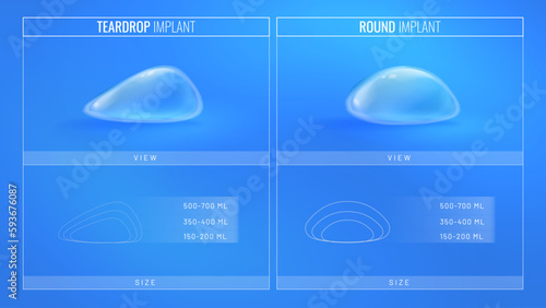 Types of breast implant for plastic surgery in a realistic style. Infographic concept for plastic surgery clinic banner. Vector illustration in futuristic style with light effects