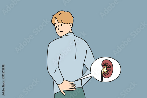 Unwell man touch back suffer from kidney pain having stones in body organ. Unhealthy guy struggle with backache from kidney. Vector illustration. 