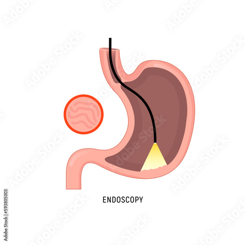 Endoscopy logo icon. Stomach gastroscopy cartoon gastritis medicine sign cancer egd system icon.