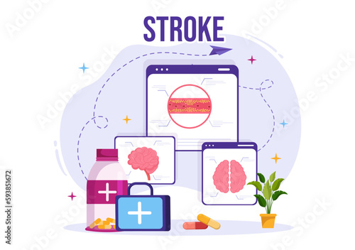 Human Brain Stroke Vector Illustration with Scientific Medical, Hemorrhage and Pain Point in Flat Cartoon Hand Drawn Landing Page Templates