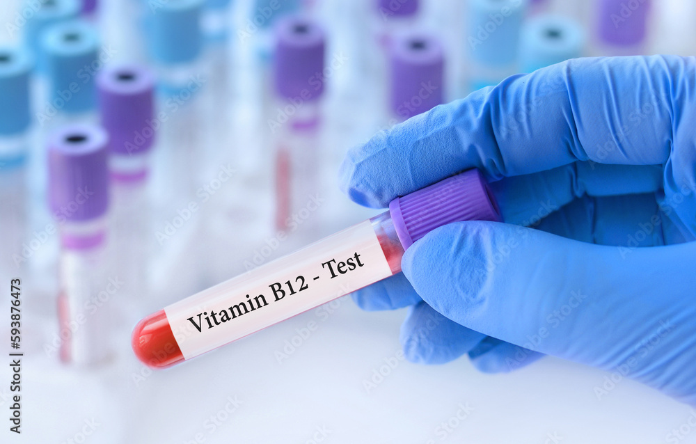 Doctor holding a test blood sample tube with Vitamin B12 test on the background of medical test tubes with analyzes Doctor holding a test blood sample tube with Vitamin B12 test on the background of medical test tubes with analyzes