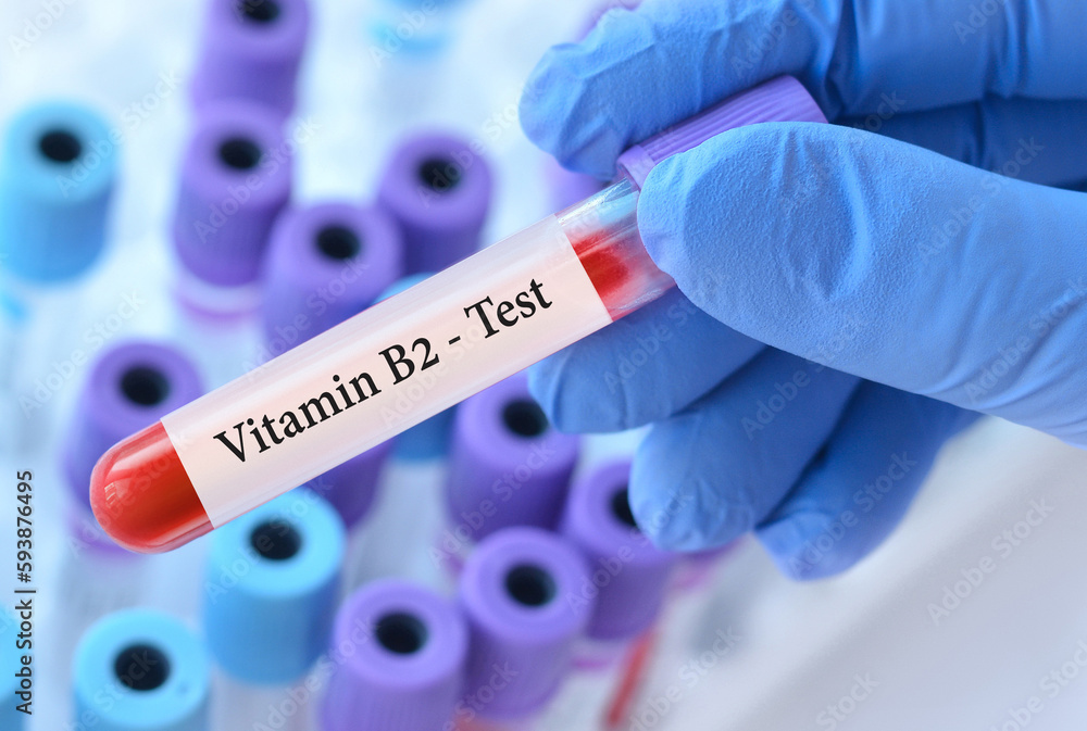 Doctor holding a test blood sample tube with Vitamin B2 test on the background of medical test tubes with analyzes Doctor holding a test blood sample tube with Vitamin B2 test on the background of medical test tubes with analyzes
