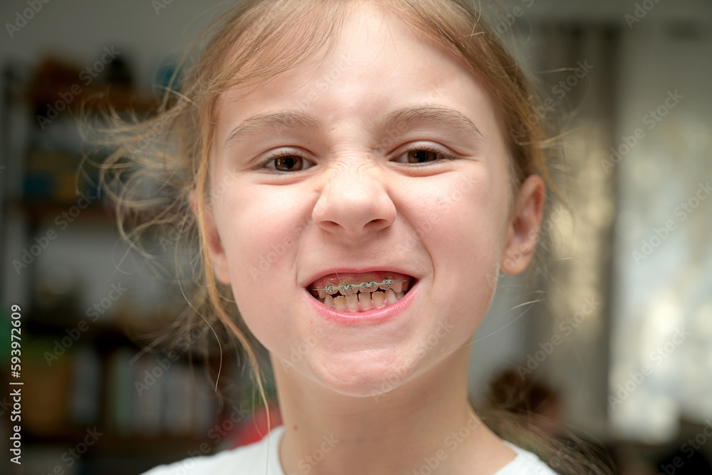smiling teenage girl with braces on her teeth