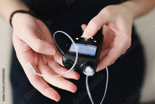 Woman holding her insulin pump in hands