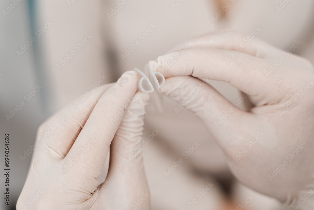 Nasal splints are installed in the nose during septoplasty to correct