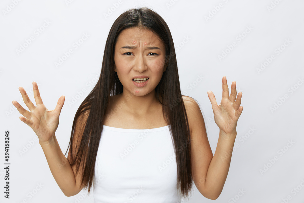 Asian woman facial skin problems, acne and inflammation, red rashes and allergies, chicken pox, sadness from rashes. Facial skin care concept for diseases and nerves Asian woman facial skin problems, acne and inflammation, red rashes and allergies, chicken pox, sadness from rashes. Facial skin care concept for diseases and nerves