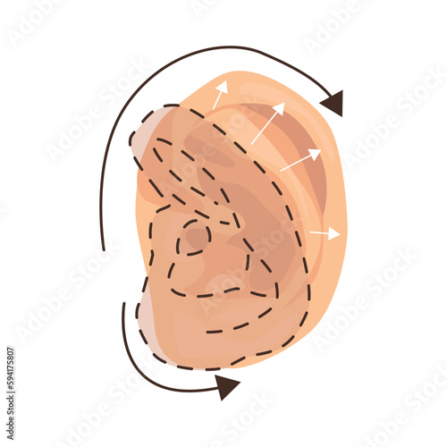 Otoplasty illustration in color cartoon style. Editable vector graphic design.