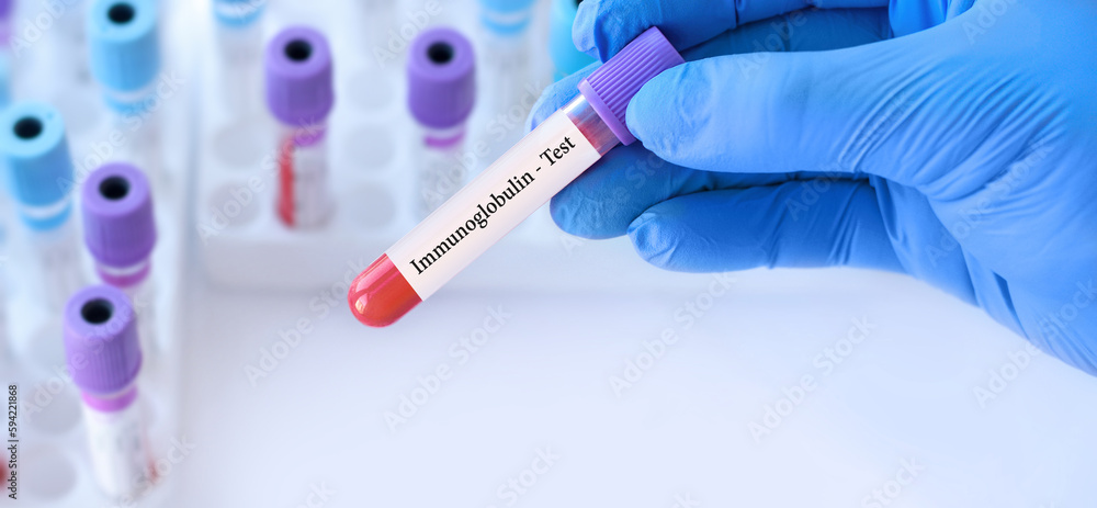 Naklejka premium Doctor holding a test blood sample tube with Immunoglobulin test on the background of medical test tubes with analyzes.Banner