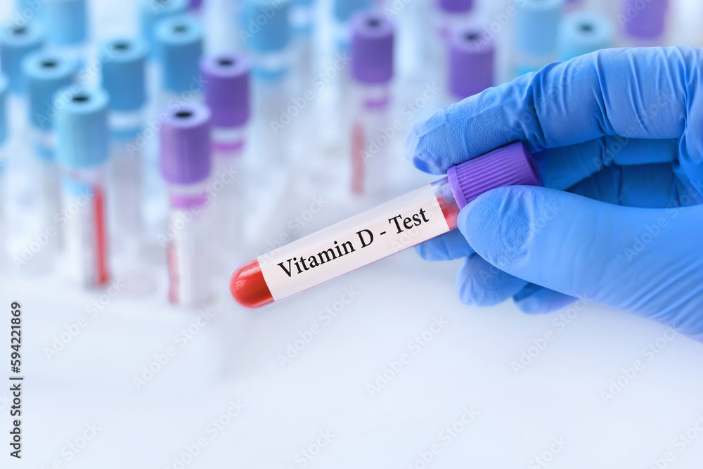 Naklejka premium Doctor holding a test blood sample tube with Vitamin D test on the background of medical test tubes with analyzes
