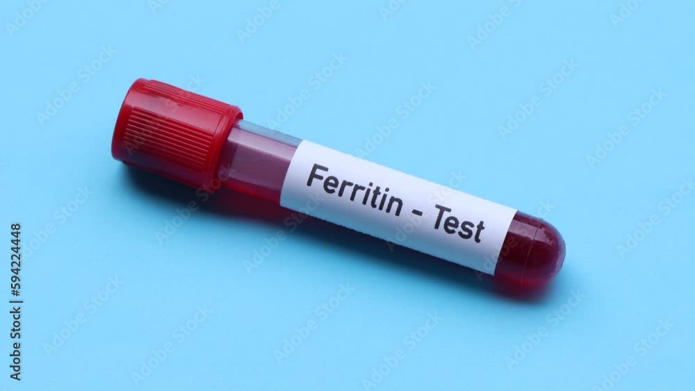ferritin test to look for abnormalities from blood, blood sample to
