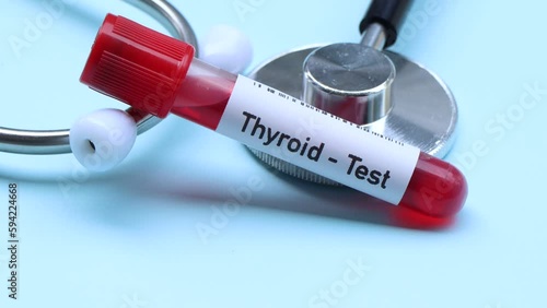 Thyroid test to look for abnormalities from blood,  blood sample to analyze in the laboratory, blood in test tube photo