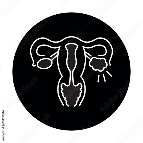 Polycystic ovary syndrome line color icon. Female reproductive system disease