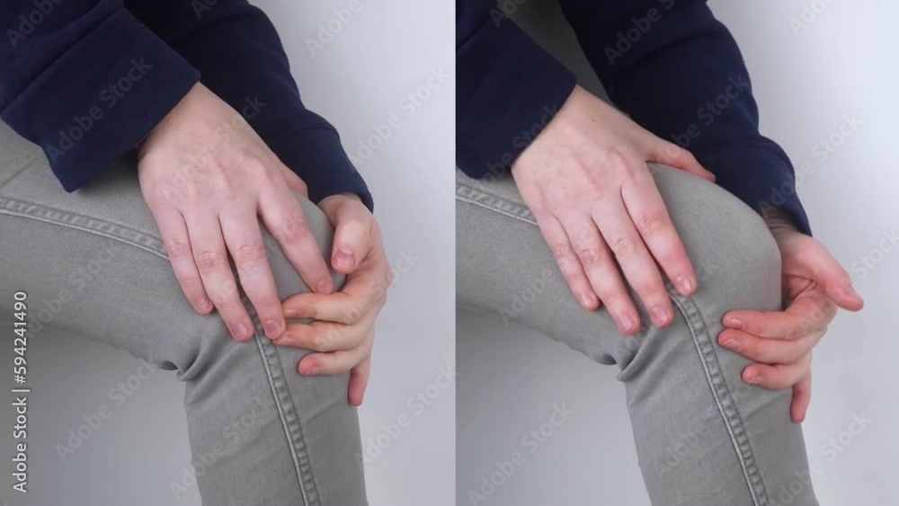 Before and after. Woman has severe knee pain. Ruptured knee tendons