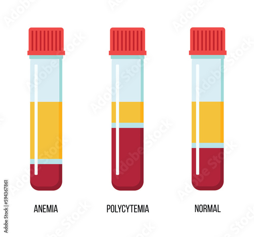 The Composition of Blood poster. Red blood cells, white blood cells, platelets and plasma. Set of vector test tubes with caps