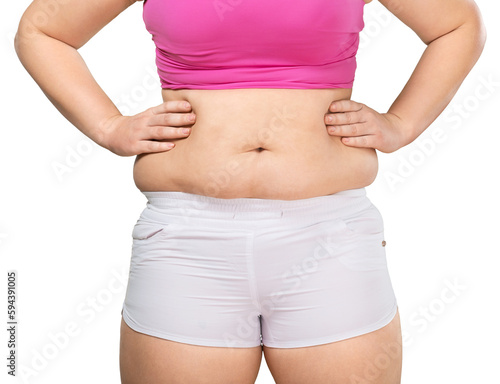 Overweight lady standing with stomach exposed