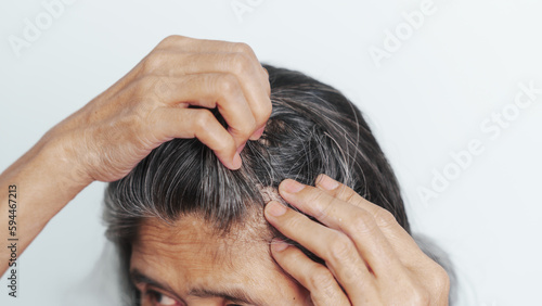 Close up older elderly asian chinese woman gray hair worry cancer worry about hair loss
