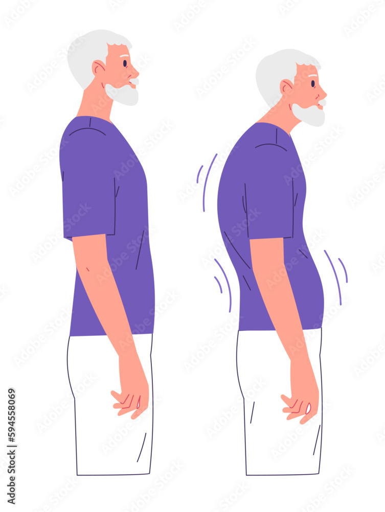 Elderly man with impaired posture and correct posture Elderly man with impaired posture and correct posture
