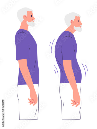 Elderly man with impaired posture and correct posture
