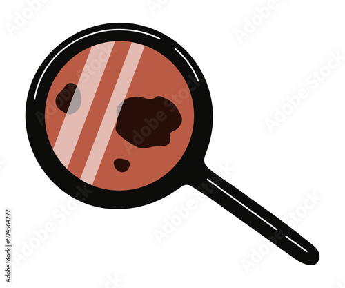 Melanoma diagnosis, skin cancer prevention icon. Checking moles, birthmarks under magnifying glass. Vector illustration isolated on white background