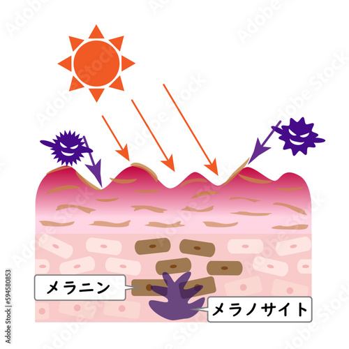 紫外線でシミができる様子を表した図。
肌荒れした皮膚の断面図。