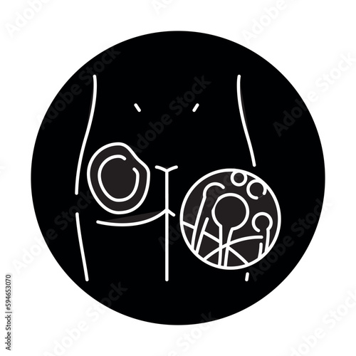 Cutaneous mucormycosis color line icon. Human diseases.
