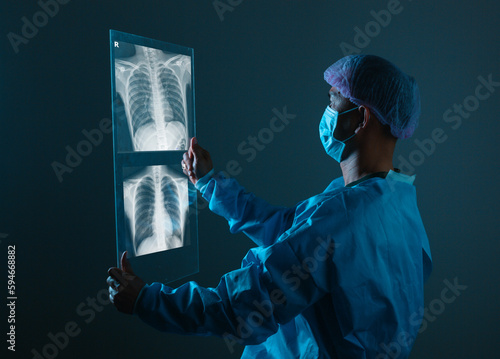 lung radiography concept. radiology doctor examining at chest x ray film of patient at hospital room.