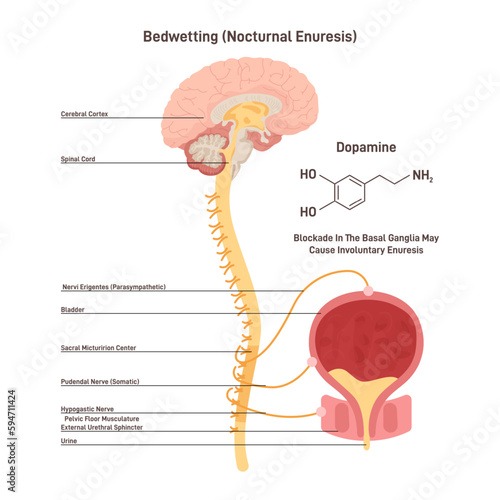 Nocturnal enuresis or bedwetting. Involuntary urination in adulthood