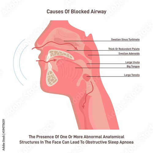 Upper respiratory tract, human nasal and oral cavity structure. Respiratory