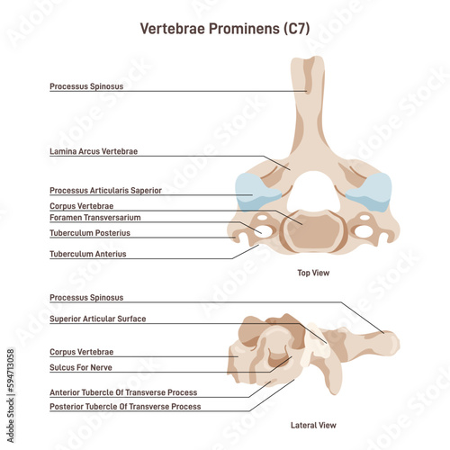 Vertebra prominens. Anatomy of the 7th cervical vertebra. C7.
